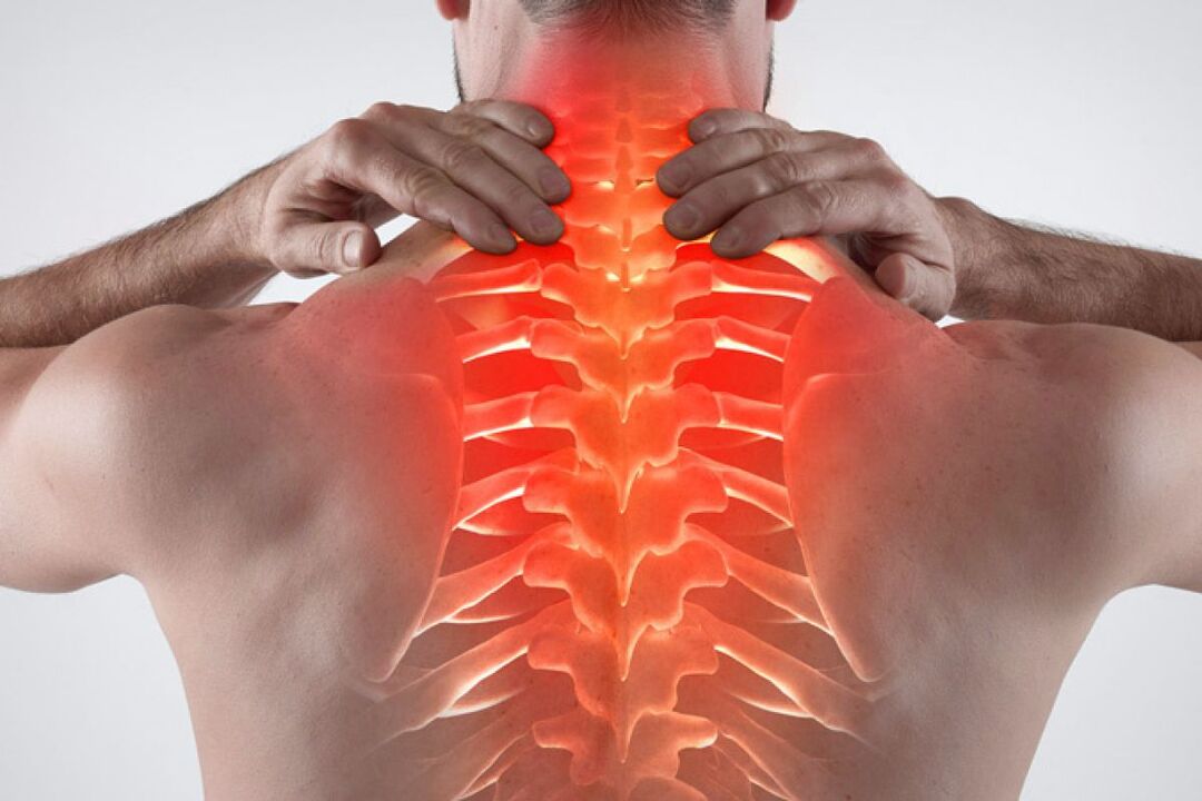 A nyaki gerinc osteochondrosis, a nyaki gallér zóna osteochondrosisának kezelése